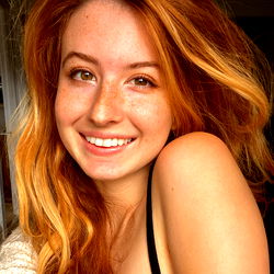 Strawberry Kisses photo